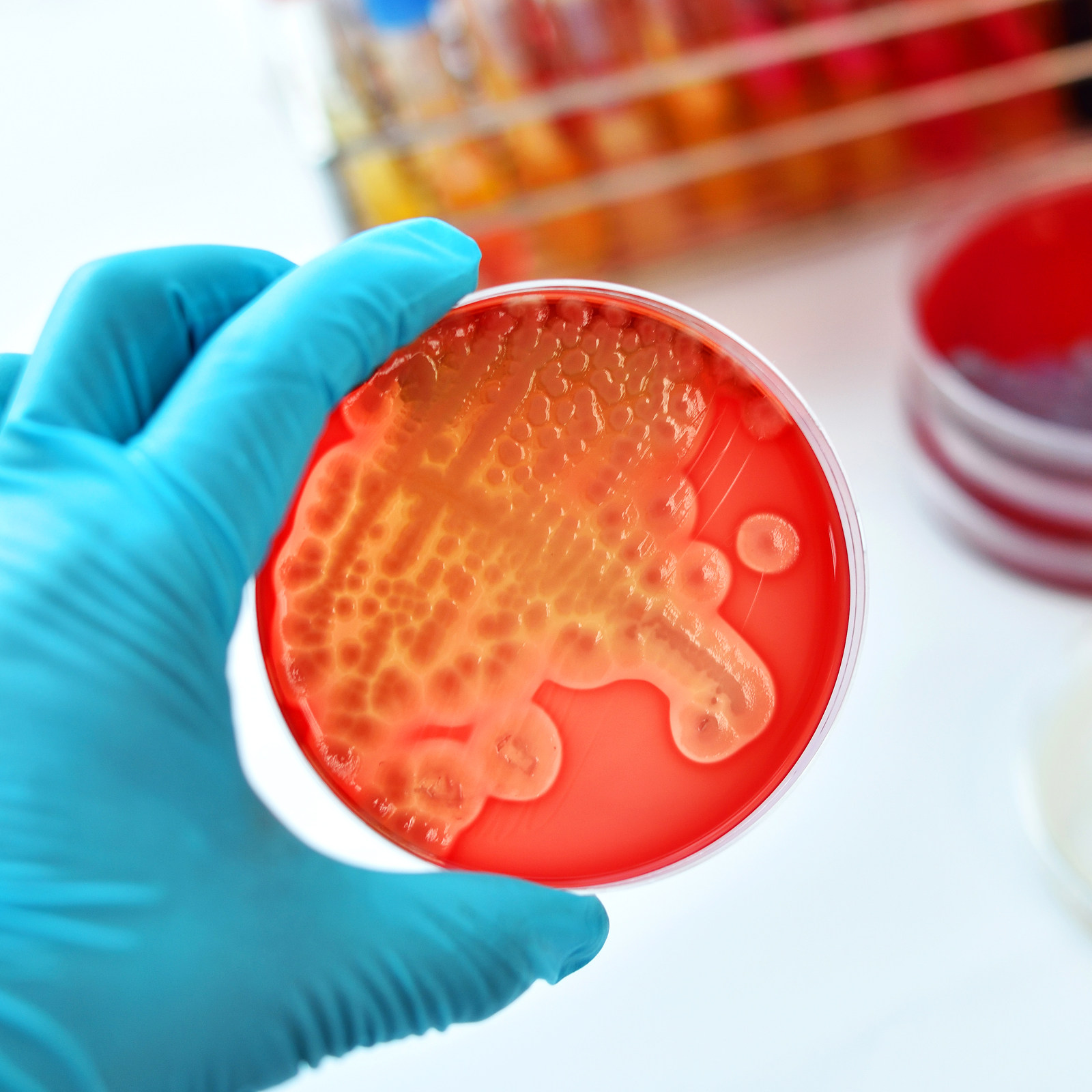 20Pcs Pre-Poured Nutrient Agar - Agar Tissue Culture 리뷰 및 가격