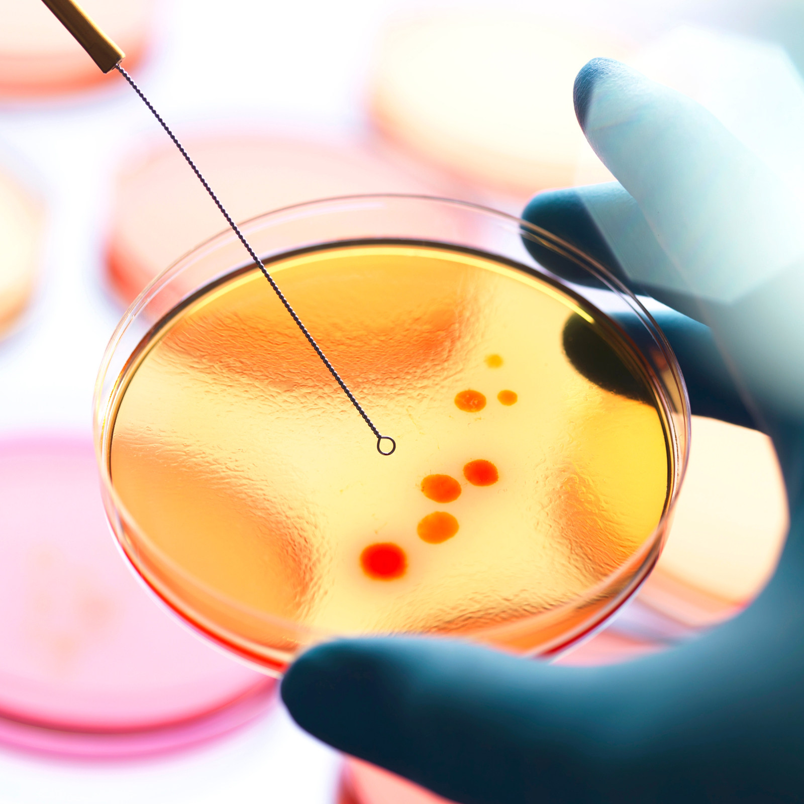 20Pcs Pre-Poured Nutrient Agar - Agar Tissue Culture 리뷰 및 가격